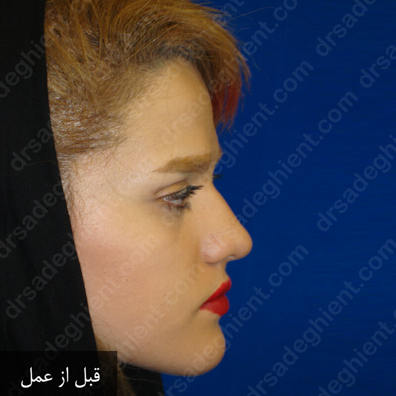 Before-نمونه کار 